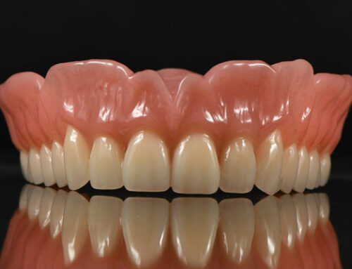 Easy occlusion for digital full dentures