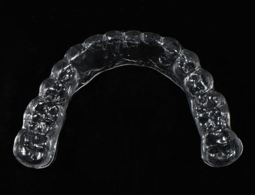 Can I make my own clear aligners?