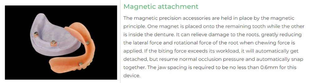 Magnetic-attachment