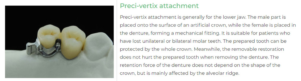 Preci-vertix-attachment