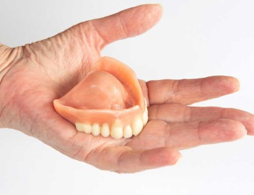 When Should You Replace Your Dentures?