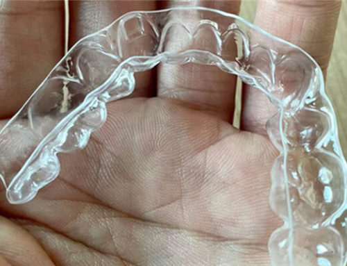 Do clear aligners really work in all cases?