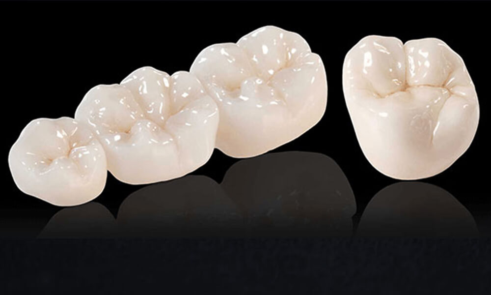 Robust Zirconia Dental Crowns