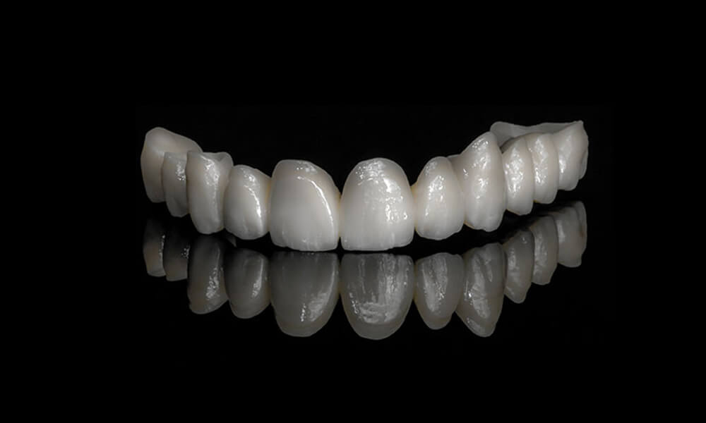 Robust Zirconia Dental Crowns