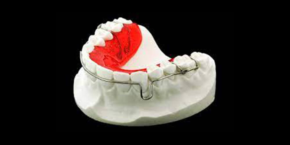Robust Dental Retainers
