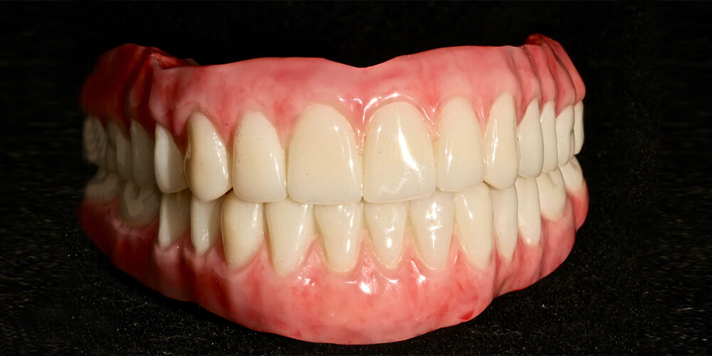 Robust Temporary Teeth