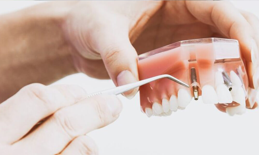 What is a normal dental procedure in the dental lab USA?