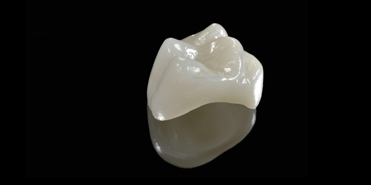 types of dental crowns-06