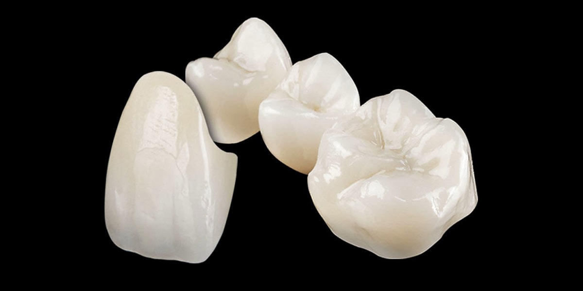 types of dental crowns-03