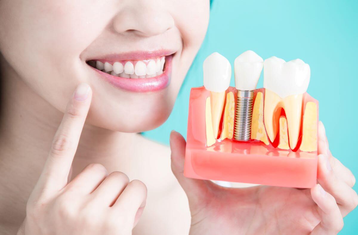 Dental implants removal-04