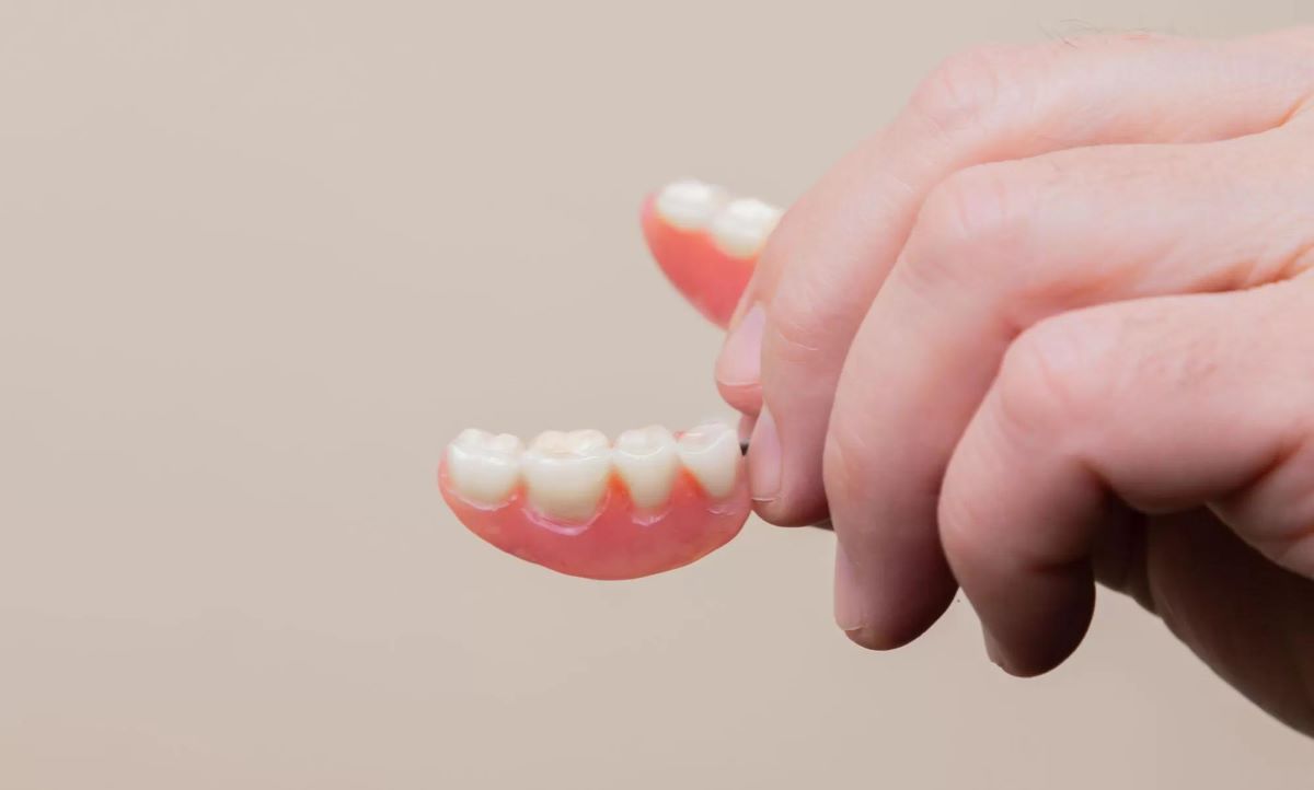 Dentures vs. Veneers-03