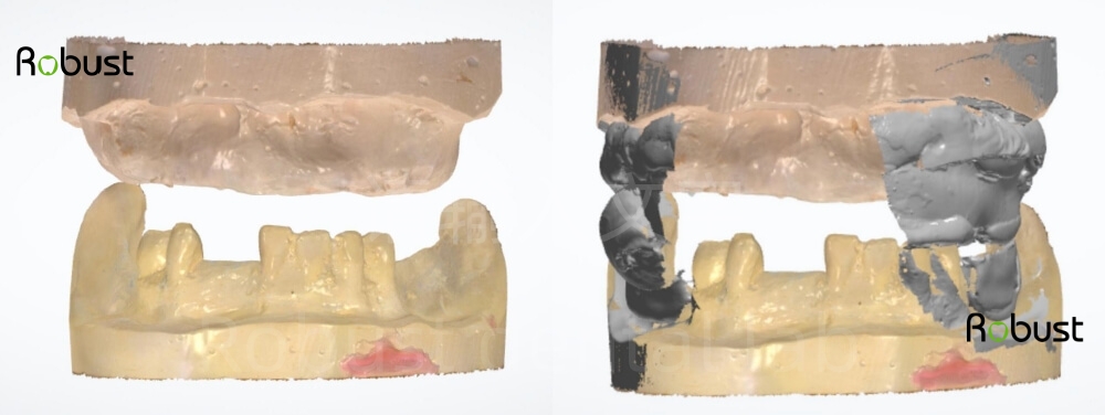 Digital scans for acrylic full dentures
