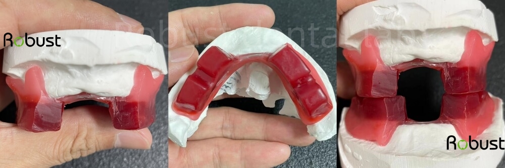 Wax rims for digital full denture