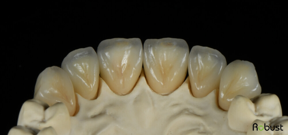 zirconia tooth cap