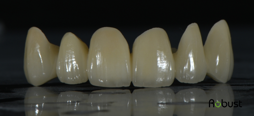 zirconium oxide dental crowns