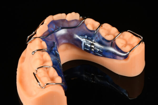 Robust Orthodontics