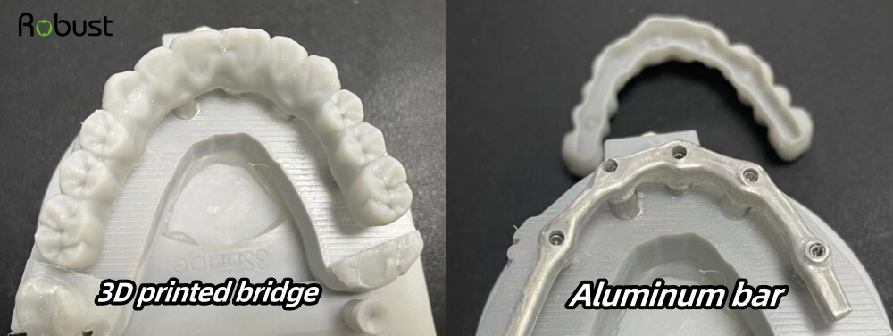 Aluminum bar and 3d print crown dental